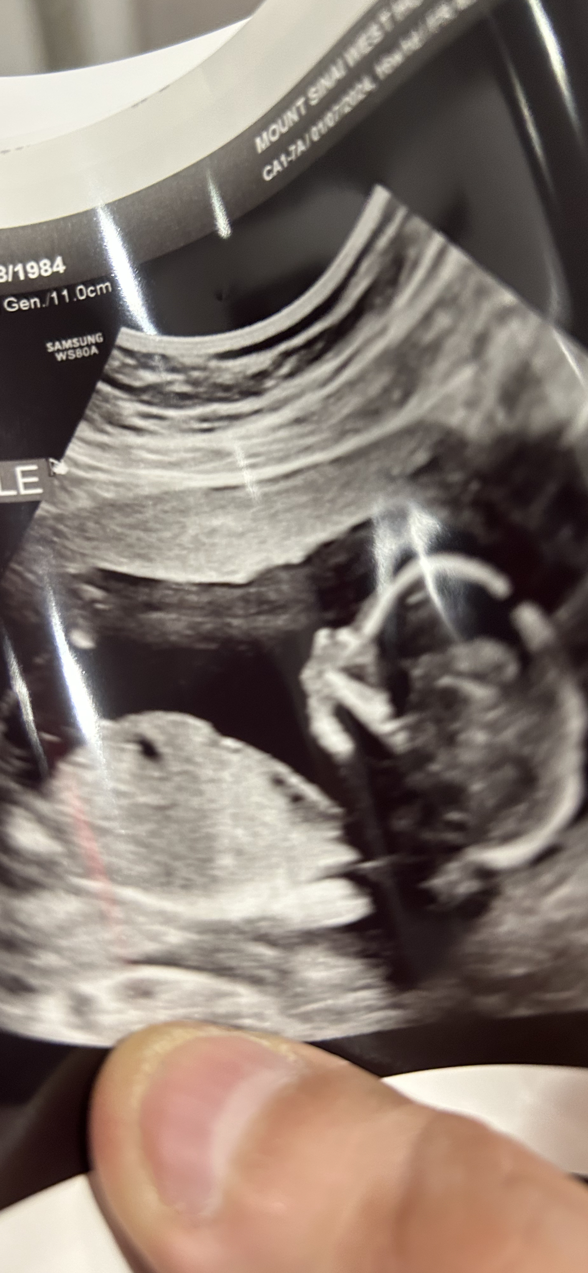 Embarking on a Unique Journey: Minus32Heartbeat’s Debut Single, ‘Dreams'”